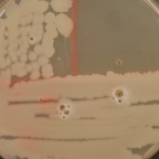 Catalase test