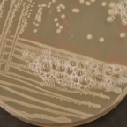 Catalase test