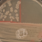 Catalase test